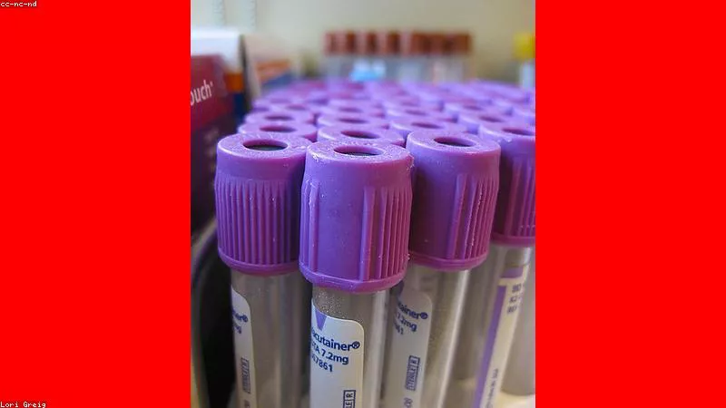 Du học Châu Âu: Đức, Pháp, Hà Lan học phí gần như miễn phí